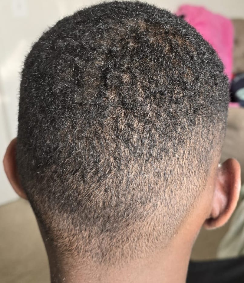  Razor Fades & Skin Fades